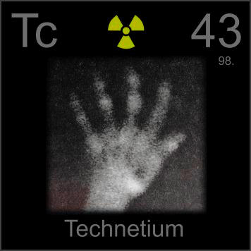 Technetium Atlas of technetium bone scans